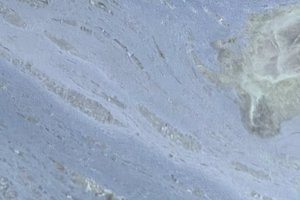 A vibrant blue granite with tonal variation and dramatic veining.  A soft blue granite with gentle m